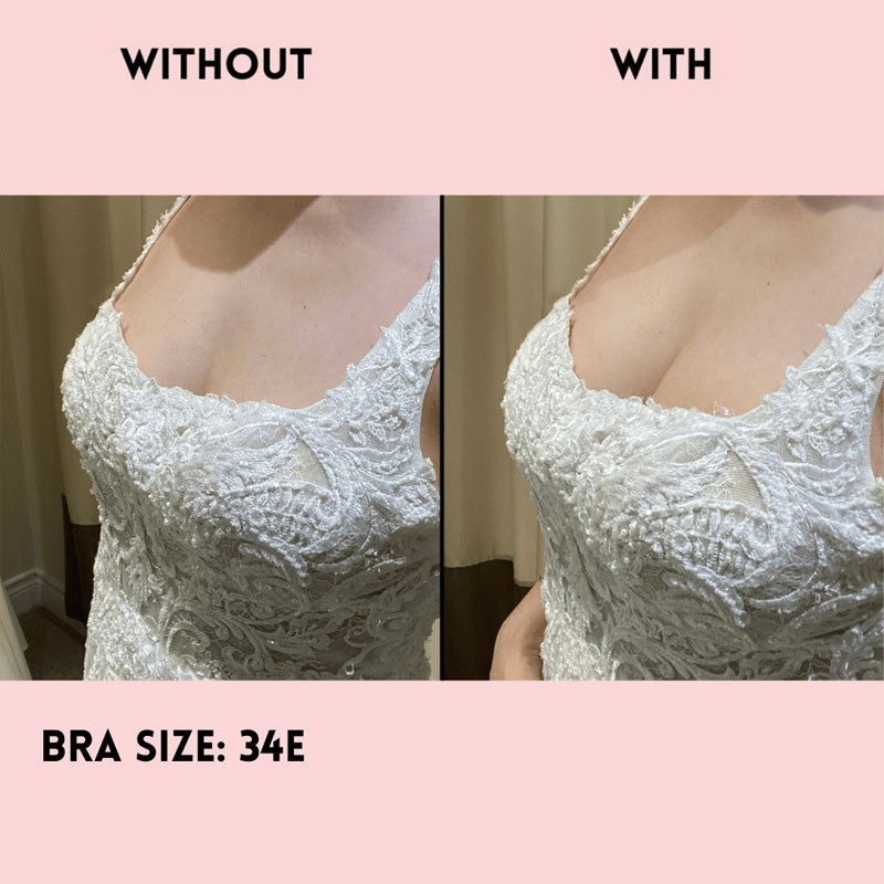 Mango-shaped silicone breast plasters