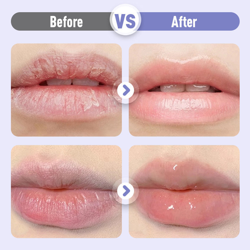 👑Moisturizing lip serum that plumps and fights wrinkles💋