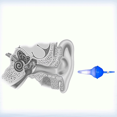 Innovative inflatable earplugs