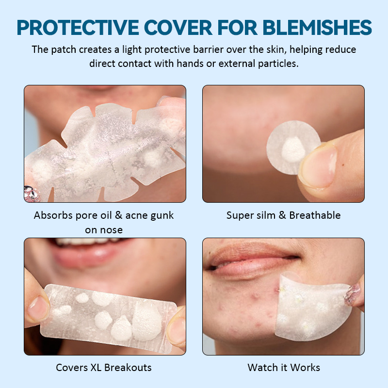 ✨ Multi-Size Acne Patch Set