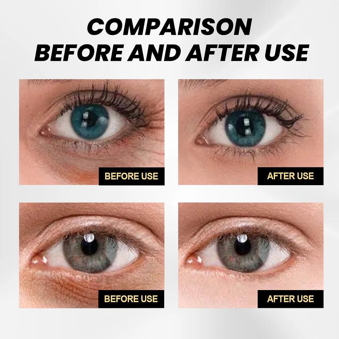 🎉Buy One, Get One Free🎁 - Instant Firming Eye Cream