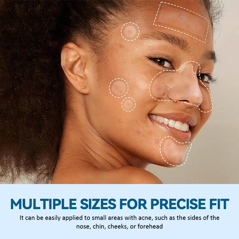 ✨ Multi-Size Acne Patch Set