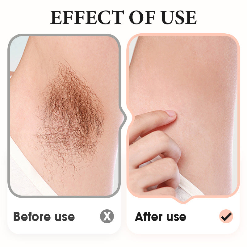 🔥Gentle Hair Removal Cream for Underarms, Legs, and Arms