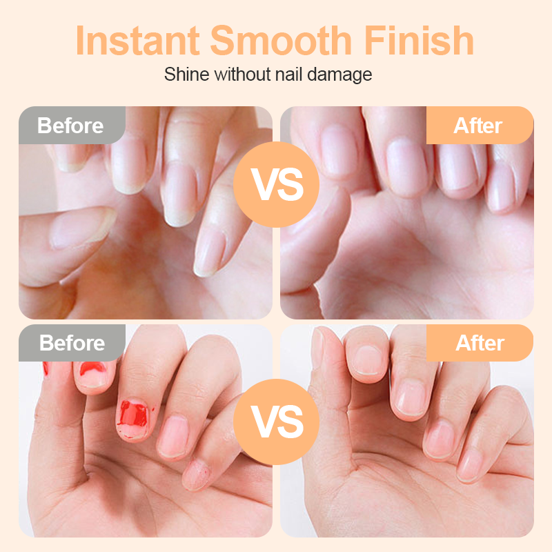 🎉 2026 Sale — Over 113,000 Sold! ✂️ 2-in-1 Smart Electric Nail Clipper & Polisher – Anti-Pinch Safety & LED Light 💅